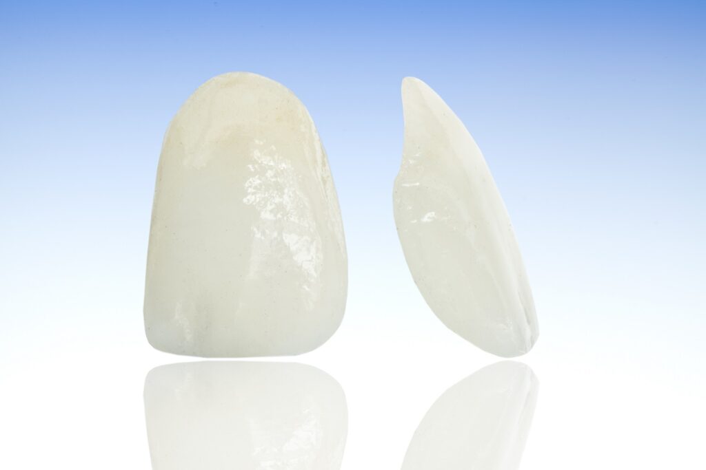 Why Choose Porcelain Veneers?
