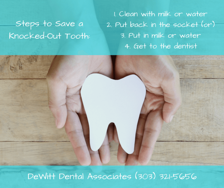 What to Do With a KnockedOut Tooth Dental Clinic in Cherry Creek