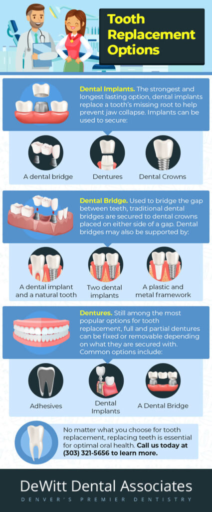 Tooth replacement